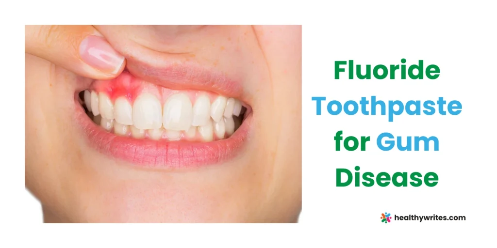 Fluoride Toothpaste for Gum Disease